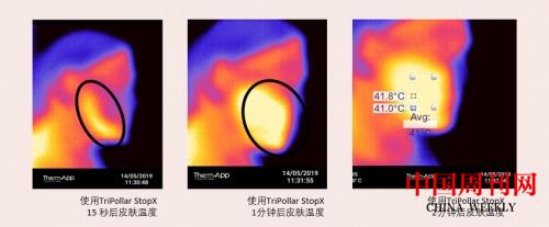 import_1650937678160420170010_a700xH.jpg import_1650937678160420170010_a700xH.jpg